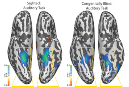 essential anatomy app brain