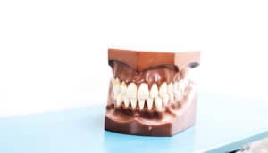 fake teeth smile (smiling at work concept)