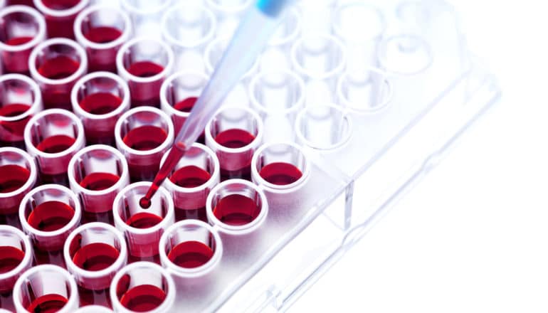 pipette and well plate with red liquid - MS biomarker