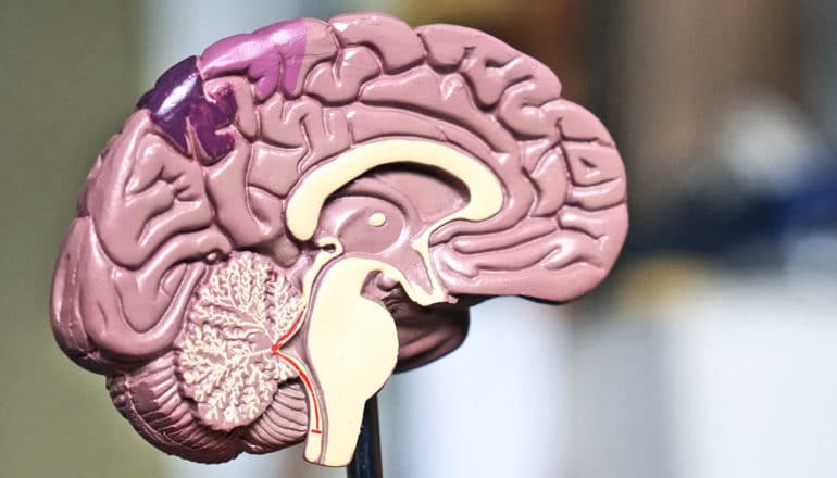 One half of a model of a human brain sits on a stand