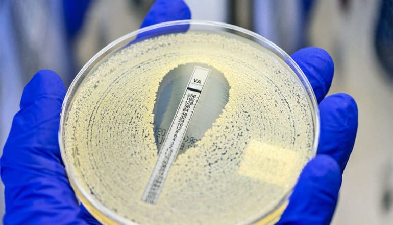 A blue-gloved hand holds a petri dish covered in MRSA with appears in small yellow dots that form larger circles in the dish