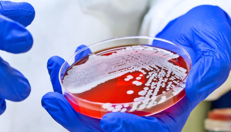 Polymer kills 99.9% of MRSA in just 5 minutes | LaptrinhX