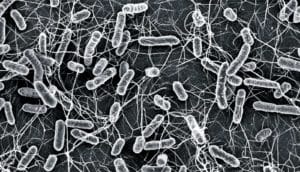 In black and white, salmonella bacteria look tadpole-like, with bulbous bodies and wiggling tails