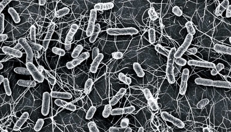In black and white, salmonella bacteria look tadpole-like, with bulbous bodies and wiggling tails