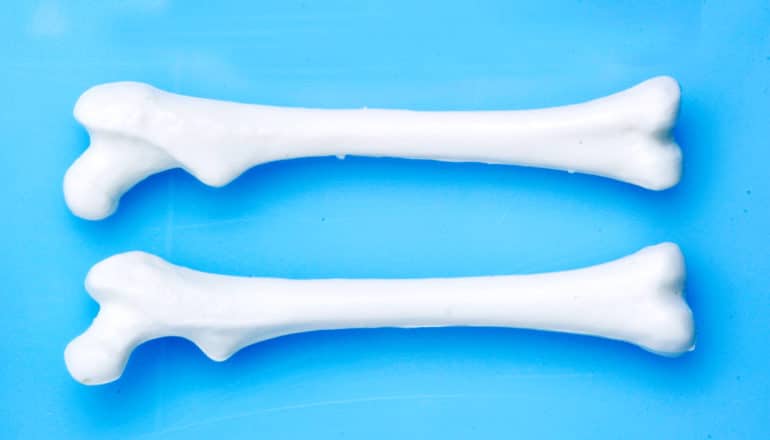 two white plastic femurs on blue