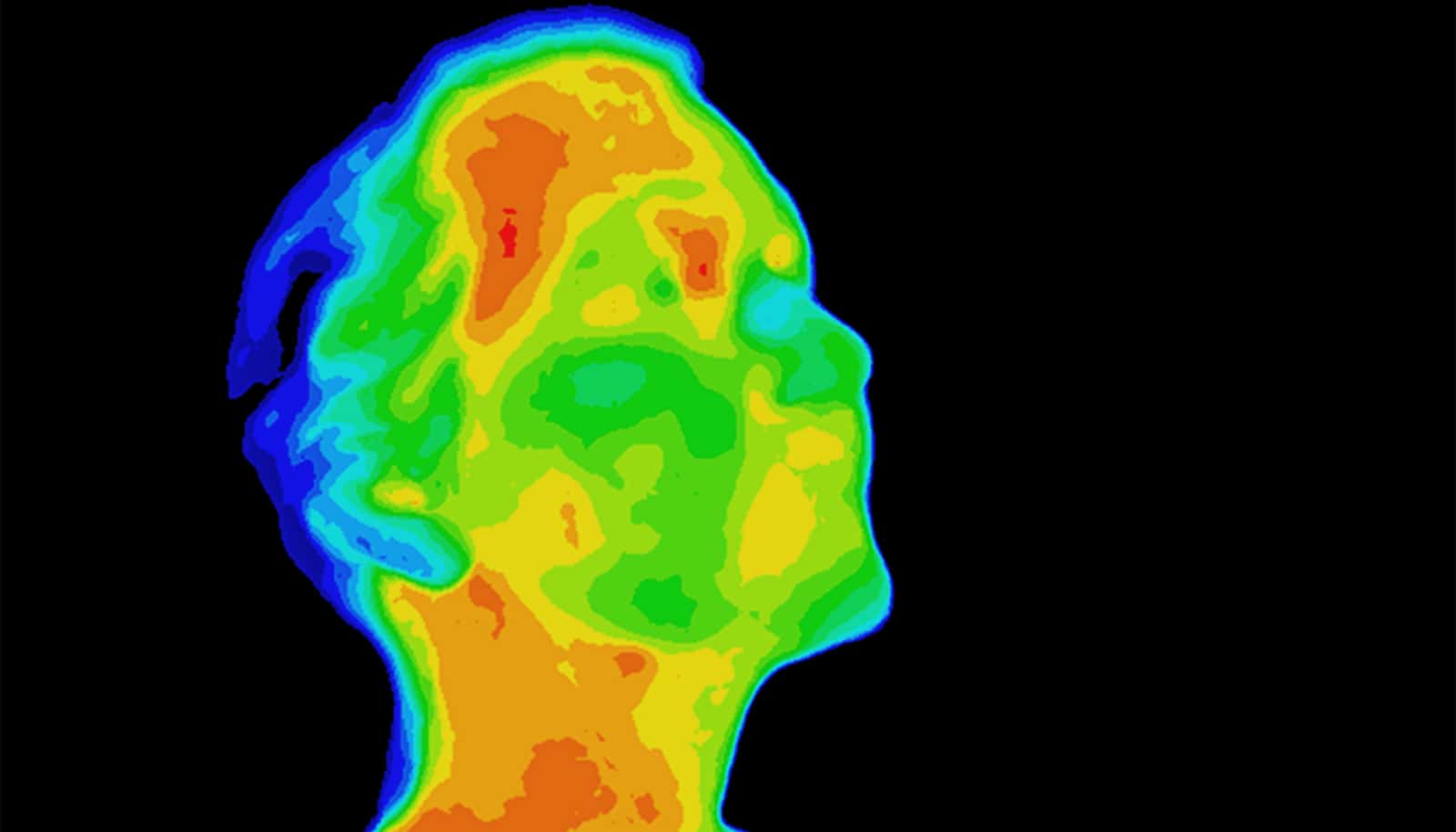 Infrared Imaging Shines A Light On Deep Tumors Worddisk