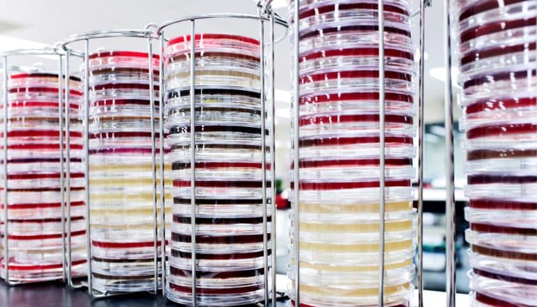 Stacks of petri dishes sit side by side