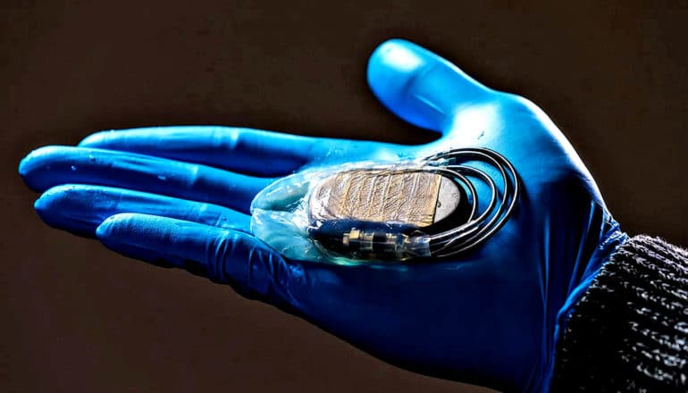 oval pacemaker device with clear membrane in palm of blue-gloved hand