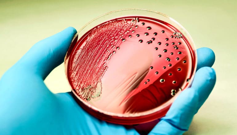 A petri dish of Salmonella looks red in the blue-gloved hand of a researcher, against a yellow/green background