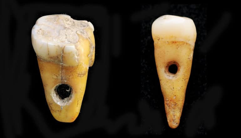 two yellowed teeth with roots with holes through the center