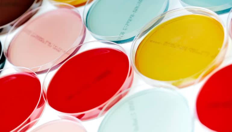 A series of petri dishes with different colors in them sit on a white background