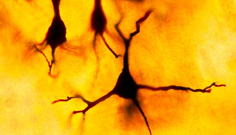 neurons on yellow