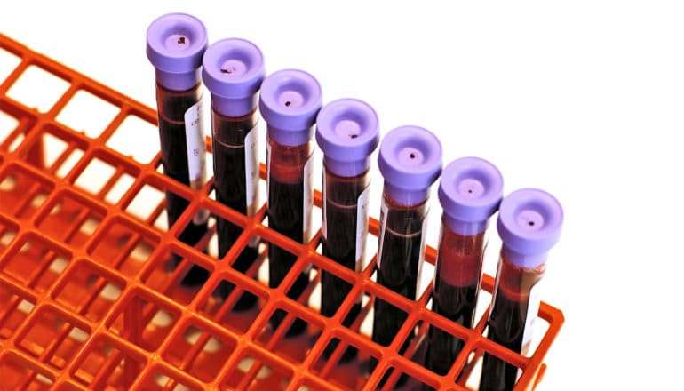 Blood vials with purple lids sit in a red rack on a white background