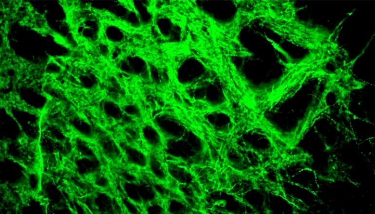 Neurons glow green against a black background