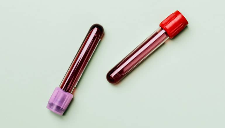 two tubes of blood