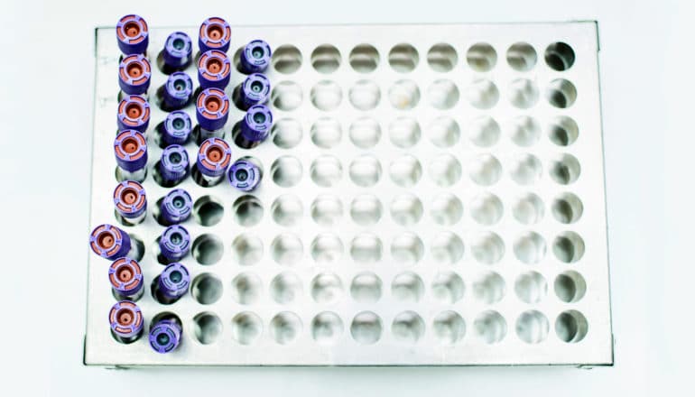 blood sample tubes in metal rack from above