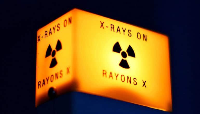 An orange light-up sign reads "X-Rays On" and has the radiation symbol