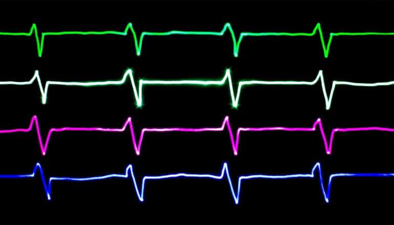 4 different-colored lines mirror the rhythm of the heart