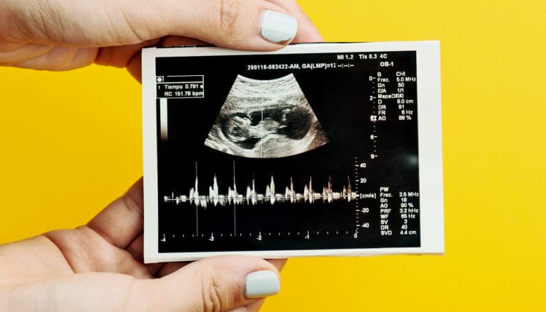 hands hold ultrasound print-out