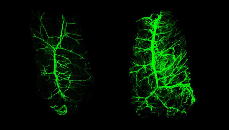 smaller and larger networks of neurons