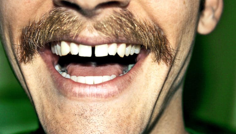 A man with a mustache smiles widely with a gap between his two front teeth