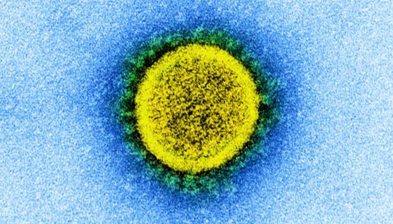 A microscope image shows the SARS-CoV-2 virus, colored to appear green and yellow against a light blue background