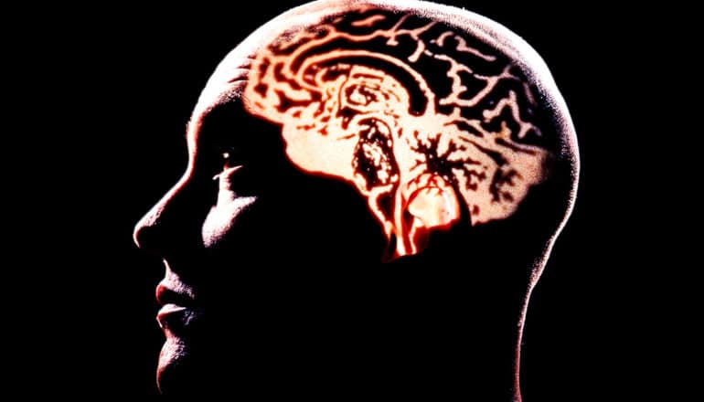 An image of a brain is projected onto a man's bald head