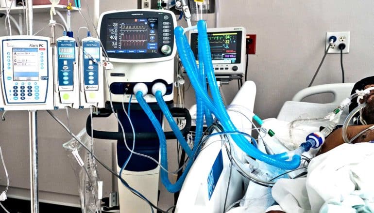 A patient is connected to a row of medical machinery in the hospital