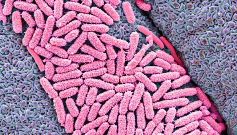 cluster of pink, rod-shaped bacteria