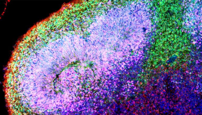 The organoid's image is made up of purple and green specks against a black background