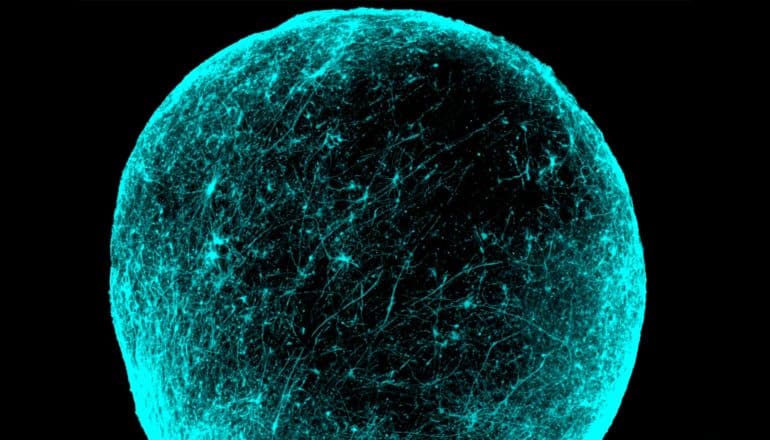 The ball of brain cells appears bright blue on a black background