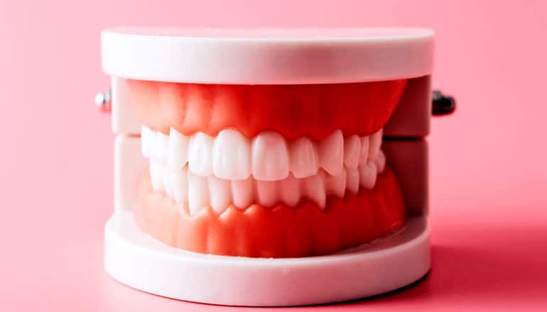 A dental model of gums and teeth on a pink background