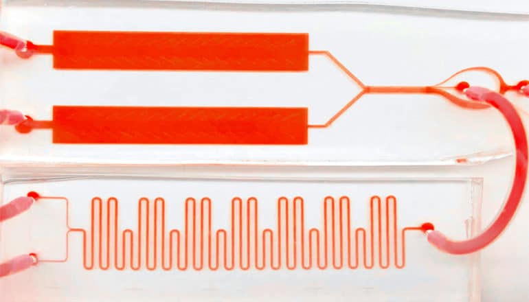 The lab-on-a-chip real-time ELISA blood test device has tiny channels with blood running through them