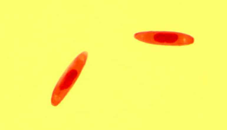 Two fungal spores appear bright red on a yellow background