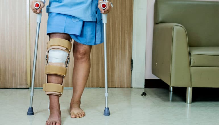 A person uses crutches to step forward with their knee bandaged after ACL surgery