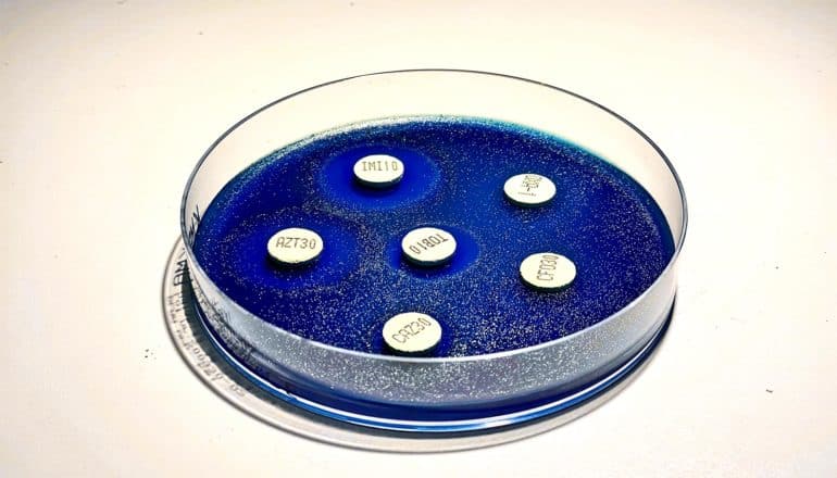 A petri dish has what look like small circles in a blue gel