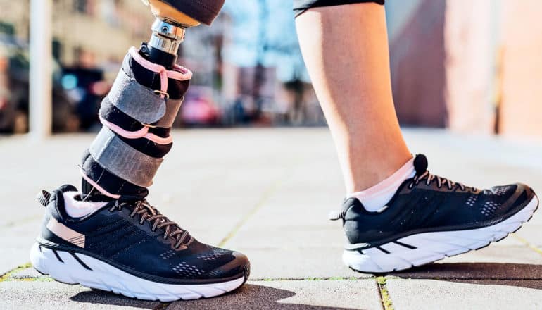 A woman with a leg prosthesis walks down the sidewalk while working out