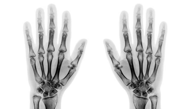 X-ray human hands