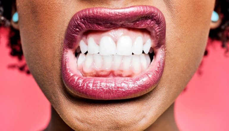 A woman shows her teeth and gums