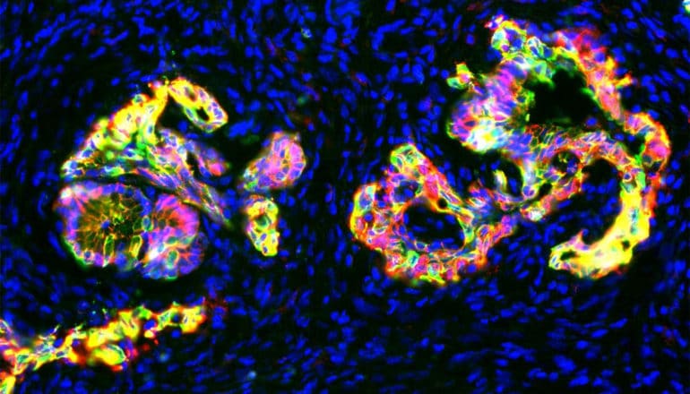 Pancreatic cancer cells in mice