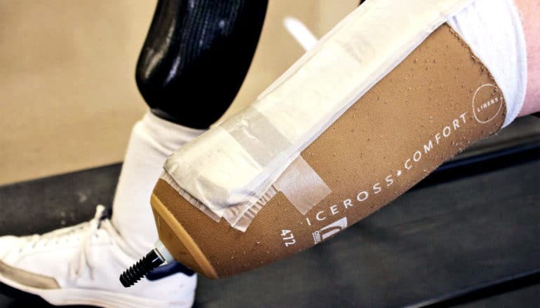 A prosthetic leg with the sensor patch on it