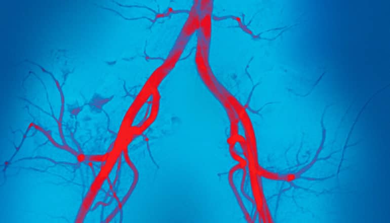 inverted V of arteries in red on blue