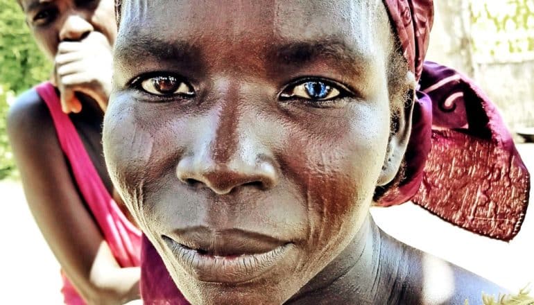 A woman with a head wrap looks at the camera while holding her child (out of frame). She has one brown eye and one blue