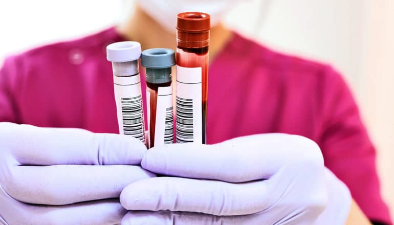 A health worker holds blood vials