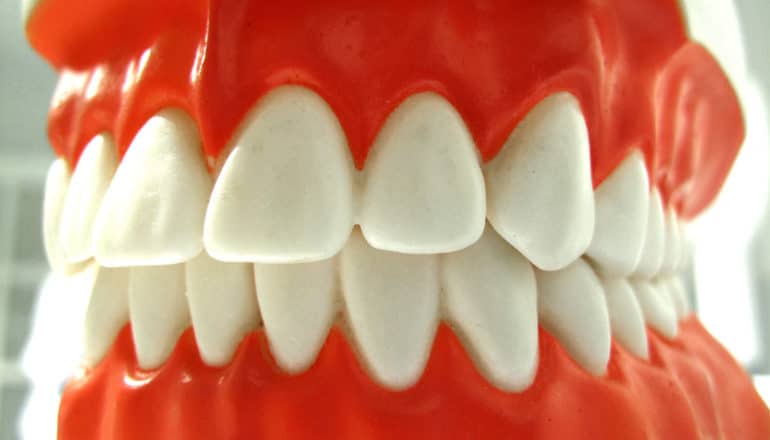 A model of teeth with bright pink gums