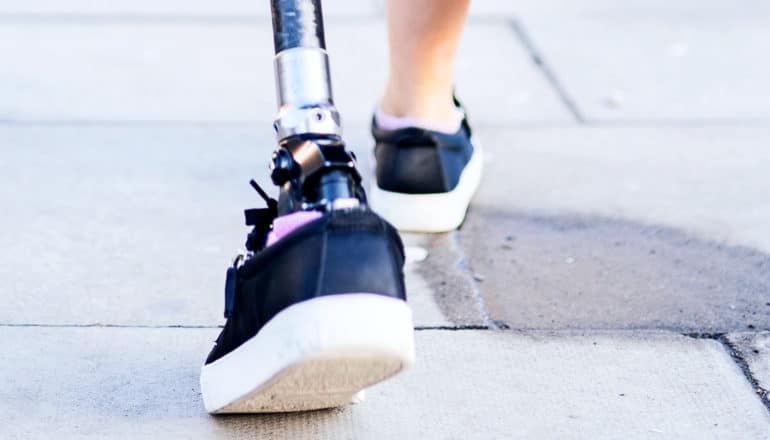 A woman with a prosthetic leg walks down the sidewalk