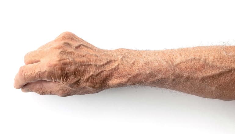 hand and lower arm of older person