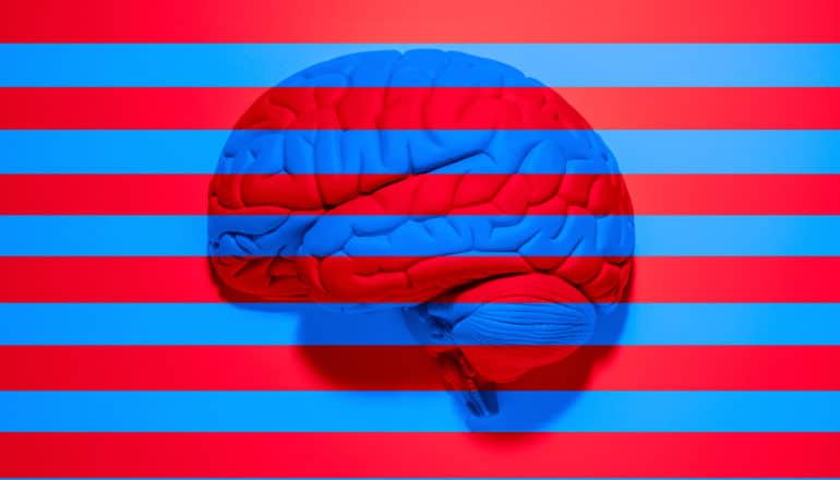 red and white stripes superimposed on image of model brain