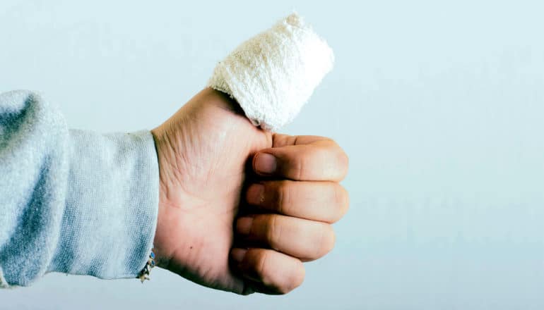 A person with a large bandage around their thumb makes a thumbs up gesture