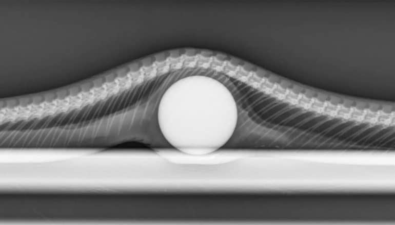 x-ray image of ball in snake